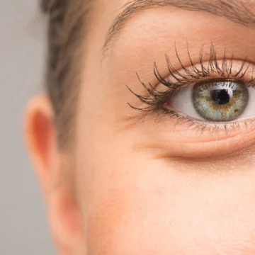 Revitalize your appearance with effective baggy eyelids treatment at Natural Slim and Glow in Mumbai