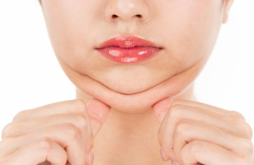 Sleek Jawline with Double Chin Reduction Double Chin