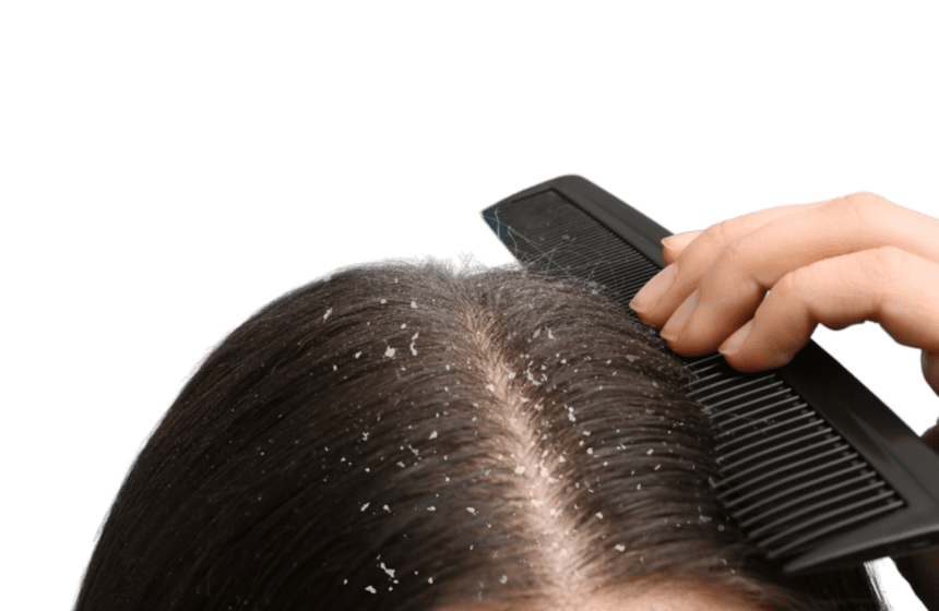 dandruff-free-scalp-treatment-mumbai-PhotoRoom.png-PhotoRoom (1) Dandruff Treatment