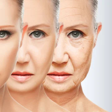 Laser technology for anti-ageing at Natural Slim and Glow in Mumbai